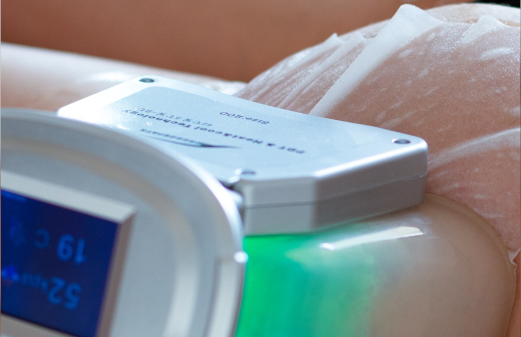 Seduta di Criolipolisi su 2 zone a scelta -76% di sconto